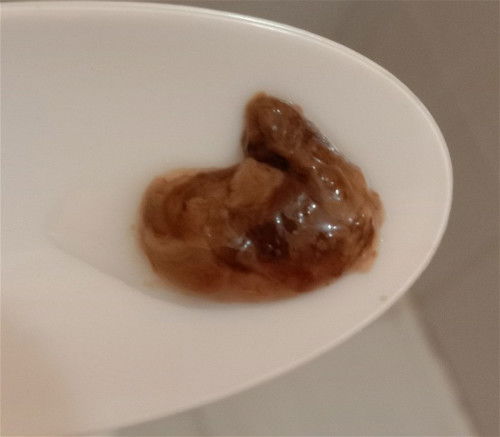FTM: Mucus plug na po ba ito?