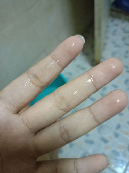 มีมูกใสๆไหลออกทางช่องคลอด