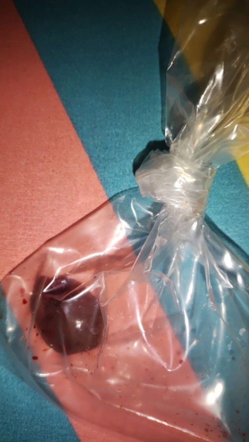 Keluar gumpalan saat hmil TM 1 usia kandunga 9 minggu