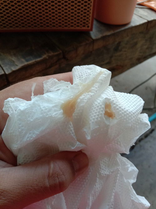 เมื่อวานขาววันนี้มาเข้มเหนียวเลยค่ะ ปากมดลูกเปิด2เซ็นมีเจ็บแบบทนได้มา2วันแล้วค่ะ