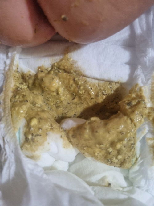 Kulay nang popoo ni baby