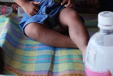 Kati-kati sa buong katawan ng bata (2 years old)