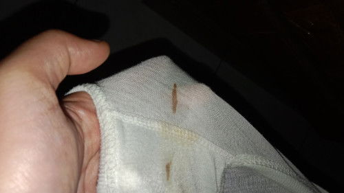 Keluar flek tapi belum ada lendir