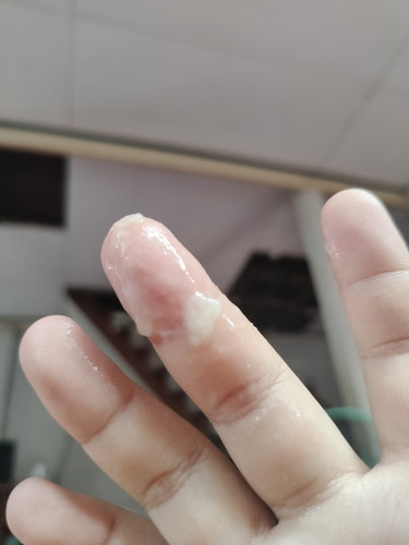 38+2วีคค่ะ