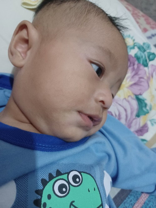Putih² dimuka bayi