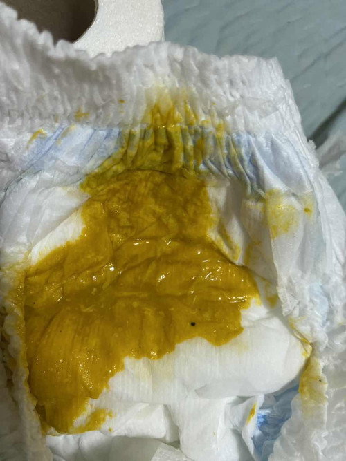 ขอสอบถามแม่ๆหน่อยคะ