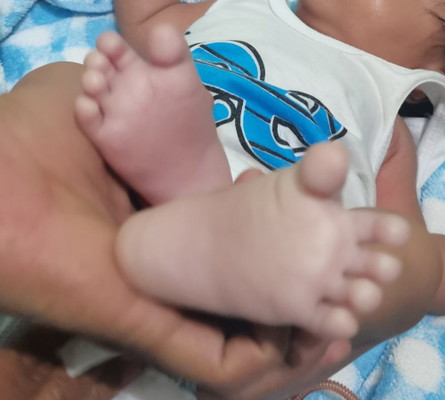 Normal po bng namu2tla ang kamay & paa ng mga ilang mins tapos po magkakkulay ulit ang 2 mnths old?