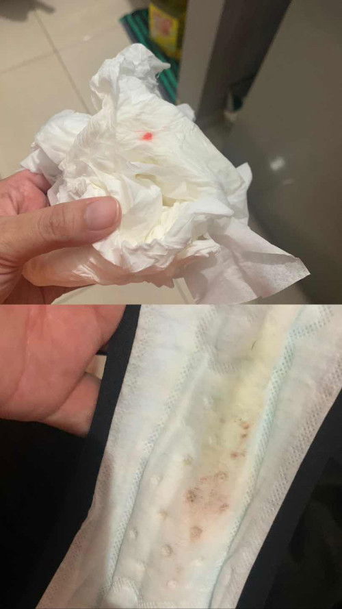 Hpl 26 April tp masih kompal dan flek sedikit pas 37 weeks masuk 38 weeks