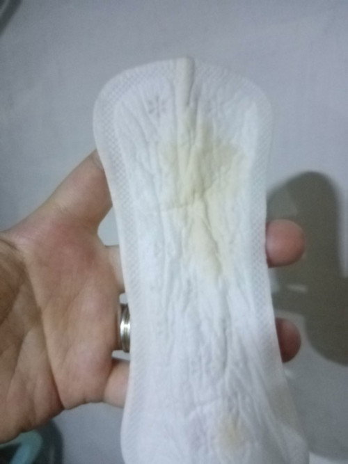 Panubigan na po ba yang nsa pix ganyan po kulay ng nalabas, 
Kung pano malalaman kung nag leak na un