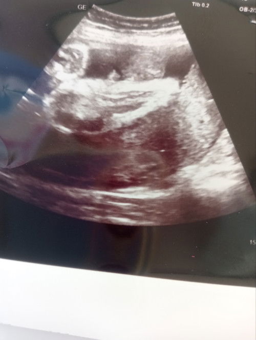 ดูยังไงคะว่าผู้ชายผู้หญิง?