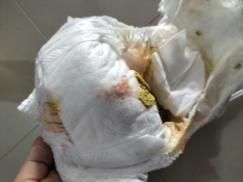 Pup ada bercak merah