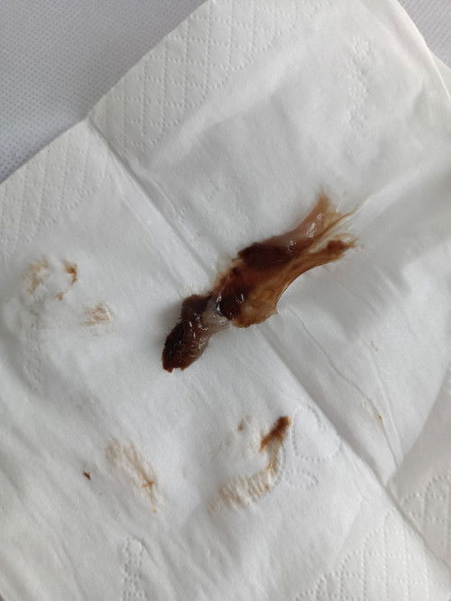 มีเลือดออก