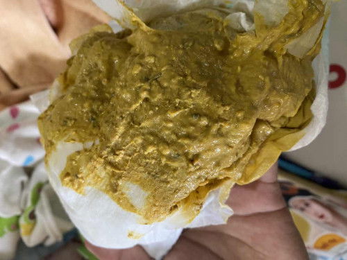 น้องอายุ30วันน้องกินนมผง+นมแม่อึน้องเป็นแบบนี้ปกติมั้ยคะที่เคยน้องอึมาจะไม่มีเม็ดดำๆค่ะ