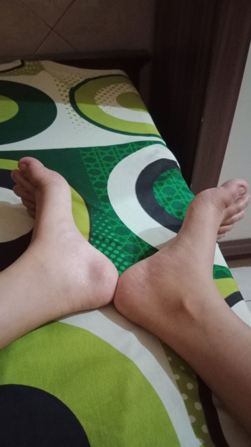 Kaki bengkak sebelah dan saran feminim wash ibu hamil yang bagus