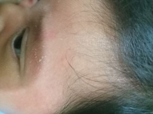 bun mau tanya muka bayi aku kering merah gini, bagus nya pake apa ya? soalnya kasian garuk" trs