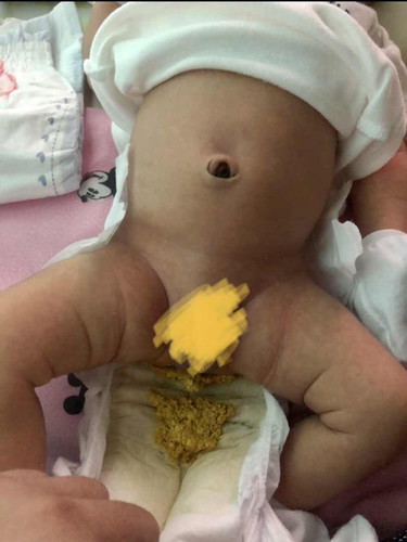 Poop ni baby 2weeks old