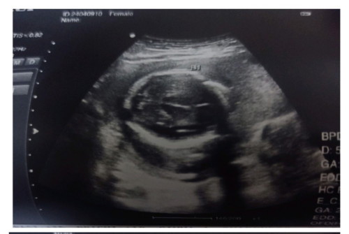 hello, anong part po ba to ni baby? 😅