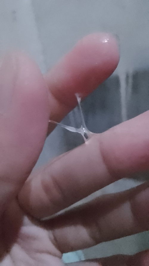 WHAT KIND OF DISCHARGE IS THIS PO? Im having a late period over 5 days already.