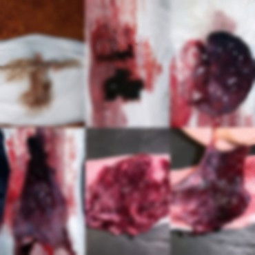 I'm 7weeks pregnant And 
 6days bleeding