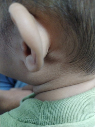 Baby sy dh 9 bulan lebih, perasan blkg telinga ada benjolan, normal ke..