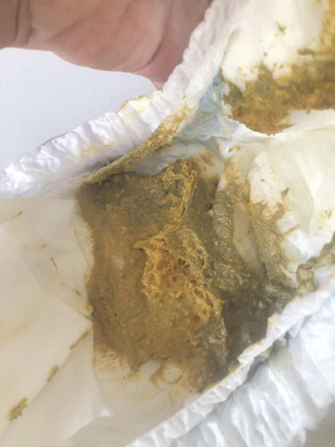 อึสีเขียวปนเหลืองปกติมั้ยคะ