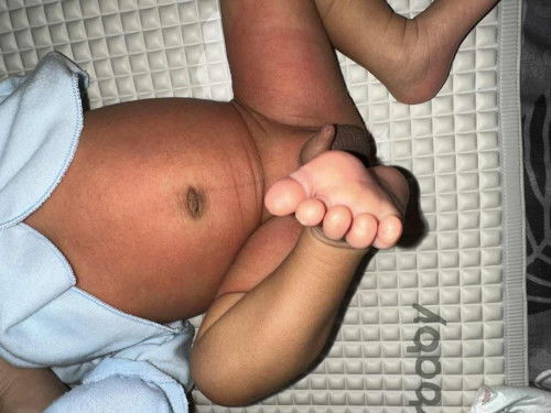 Bintik merah di selangkangan dan perut.