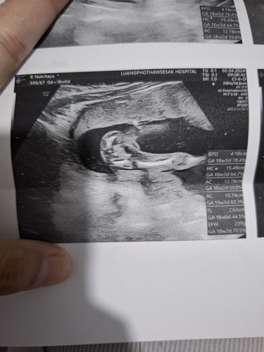 ช่วยดูเพศให้หน่อยค่ะ