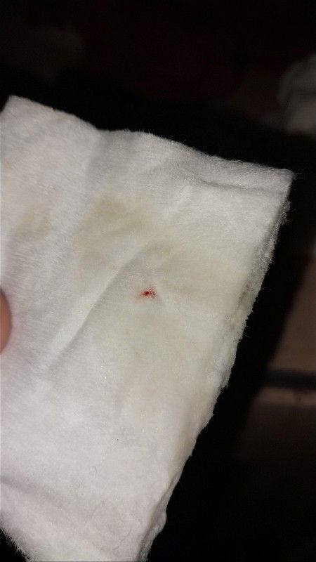 39 w 2 d keluar flek darah tpi dedek msi aktif tpi tndgnya agak lembut
Kasi saranya