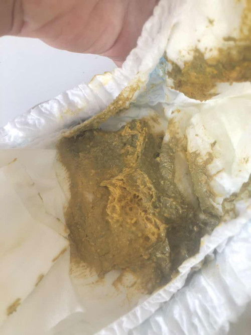 อึน้องเป็นสีเขียวปนเหลืองปกติมั้ยคะ