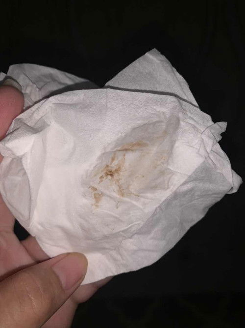 Flek coklat Usia 24w