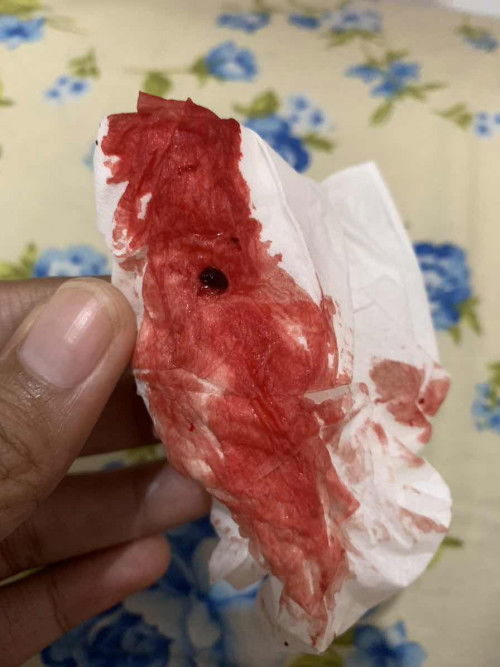 Sharing kehamilan pertama yg penuh cerita🥹 (part 1?)