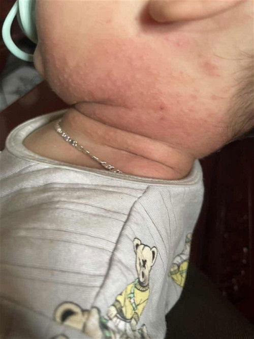 bé bị sao thế ạ