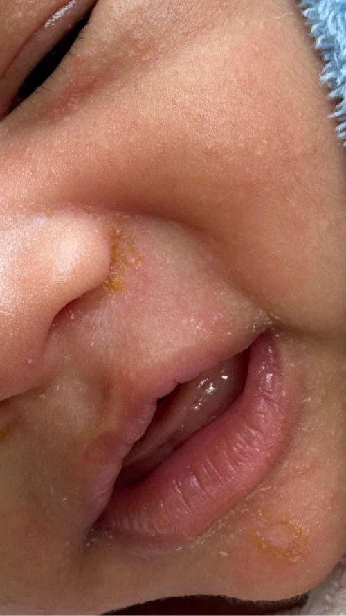 สอบถามแม่ๆแบบนี้คือน้องเป็นอะไรคะ หรือต้องไปหาหมอ