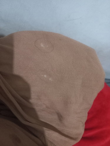 Ini termasuk ketuban rembes atau bukan ya ? Maaf jorok