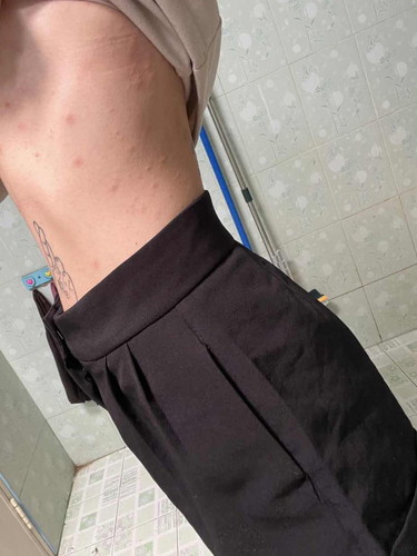 ผื่นแดงขึ้นแต่ไม่คัน