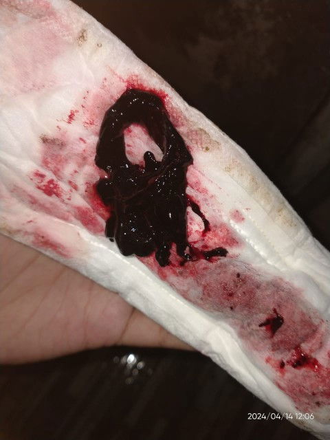 Pendarahan seperti haid beserta gumpalan darah