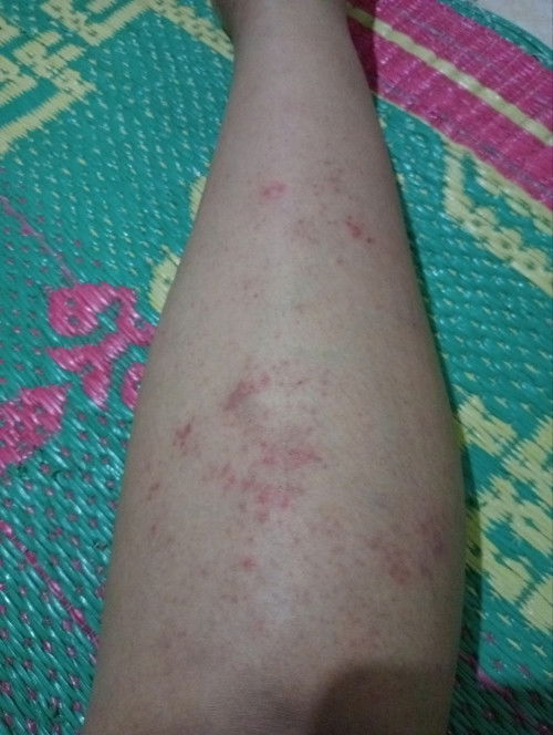 Bun mau tanya ada kah yg seperti ni ditm 3 gtal" apakh bawaan janin