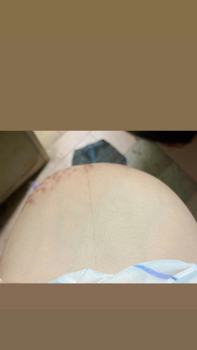 แบบนี้ท้องแข็งหรือลูกโก่งตัวคะ