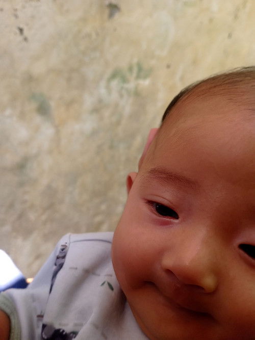 mata kanan ada melentung kecil