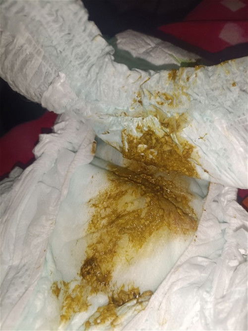 Nestogen Lowlactose to S26 Pink