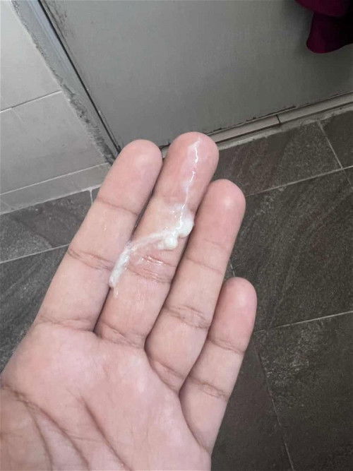 Discharge / Mucus Plug