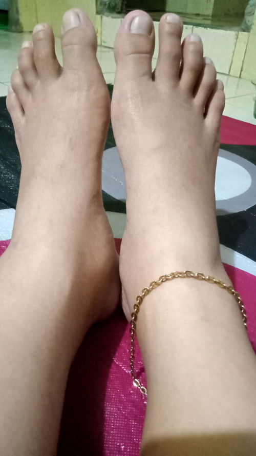 Hamil 35wk kaki tiba tiba membengkak