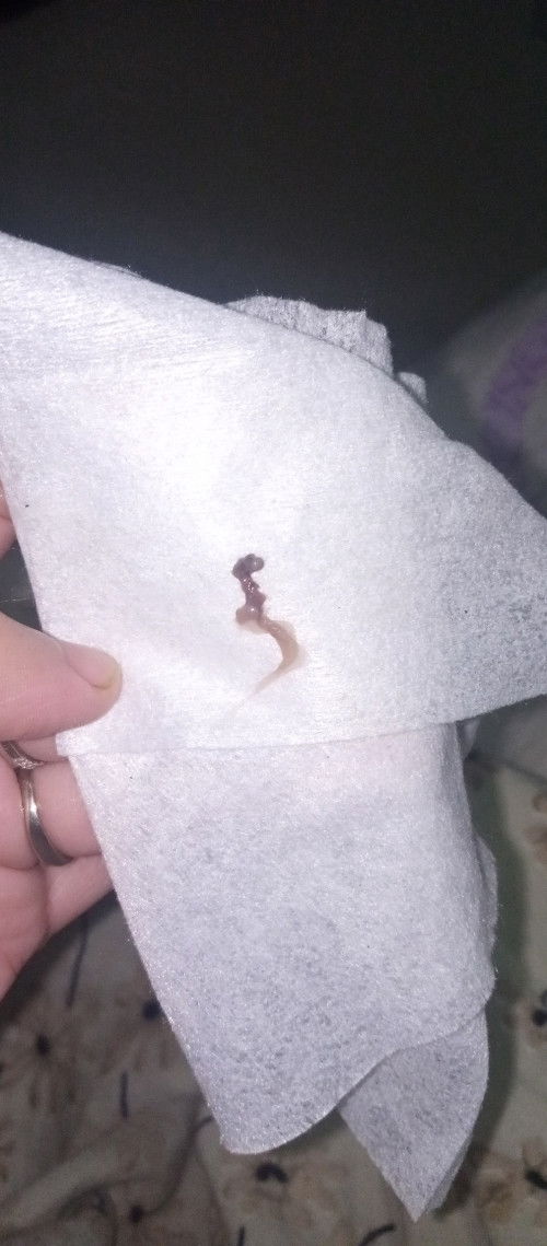 Keputihan coklat/ lendir coklat