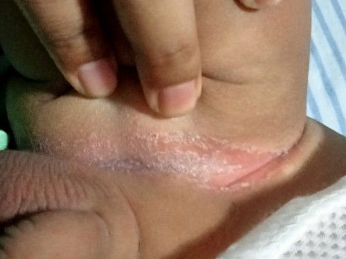 สงสัยว่าเกิดจากอะไร