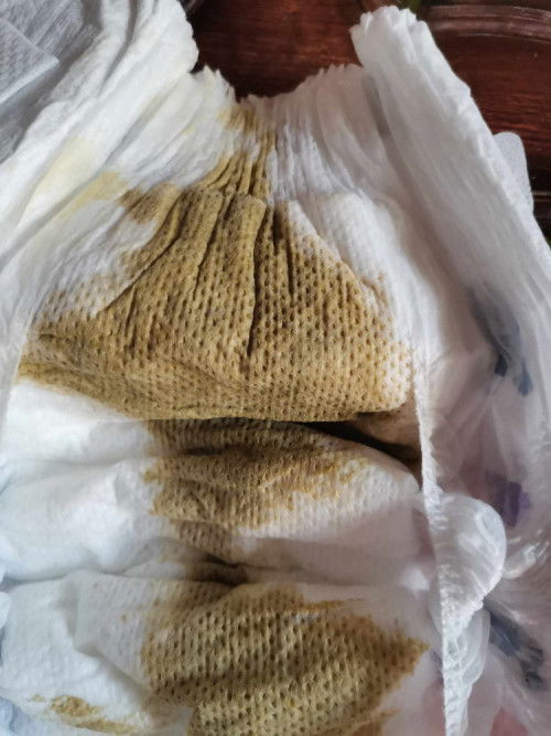 Normal lang po ba stool ng baby ko?