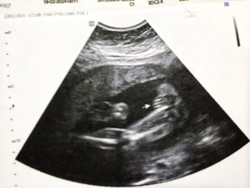 แม่ๆดูออกไหมค่ะ ว่าเป็น ชาย หรือ หญิง?