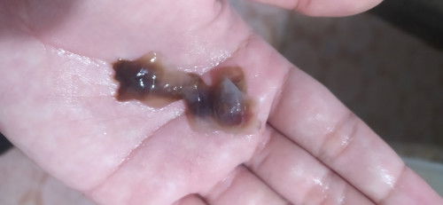 Apakah ini tanda persalinan