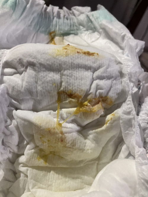 ขอสอบถามค่ะ