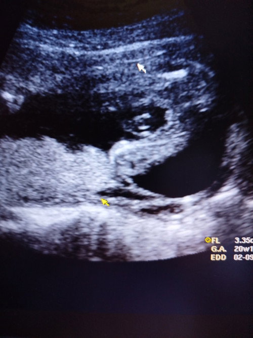 Pinjam mata berpengalaman.