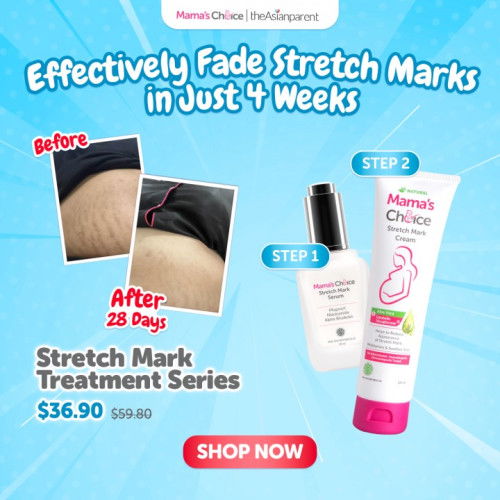Unlock the SECRET to Fade Stretch Marks the Fastest Way! 👀